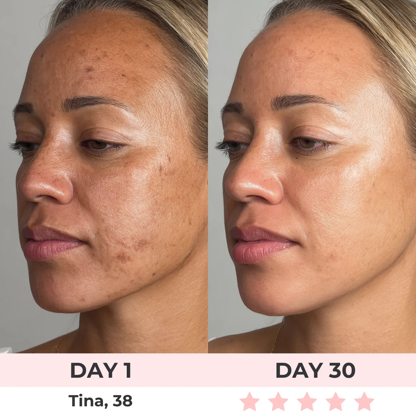 Embera 7-in-1 LED Facial Sculptor - Embera Beauty