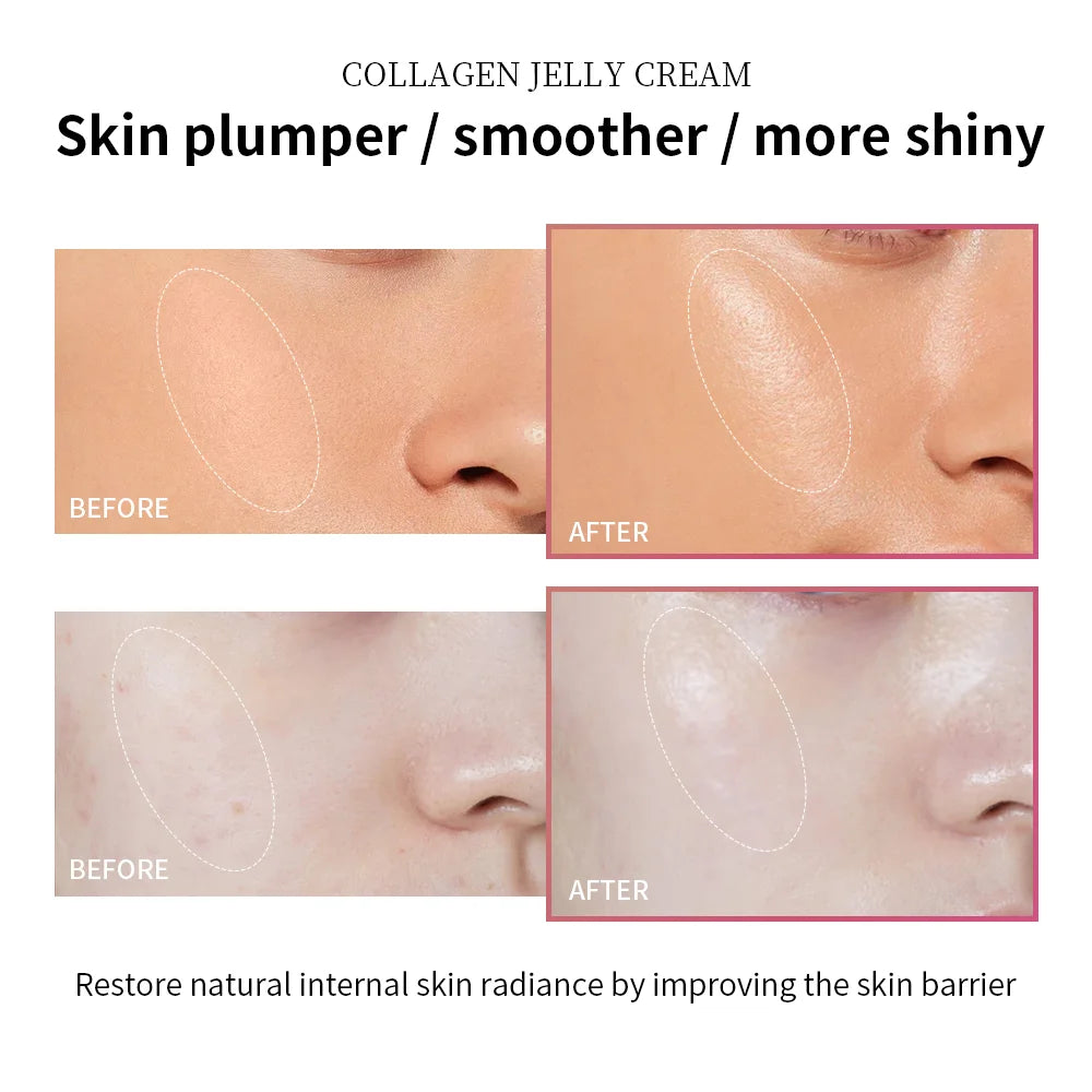Collagen Jelly Cream - Embera Beauty